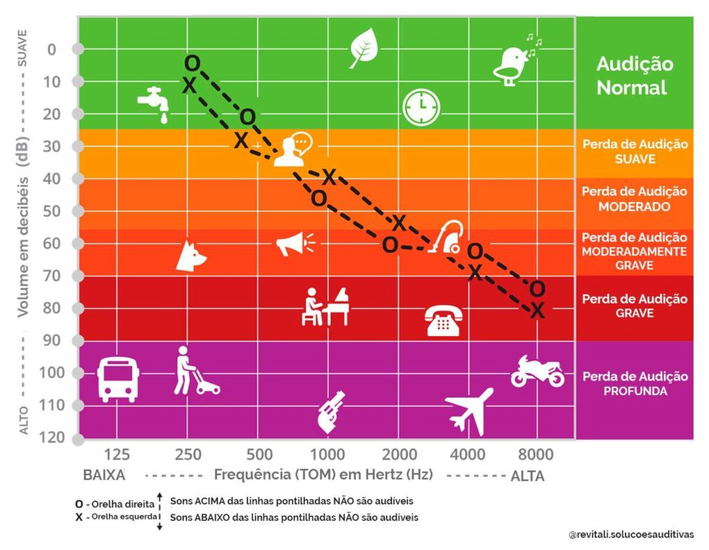 Gráfico ilustrativo de audiometria com faixas de perda auditiva e sons cotidianos