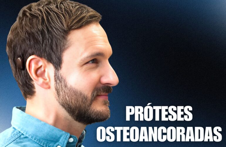 próteses auditivas osteoancoradas